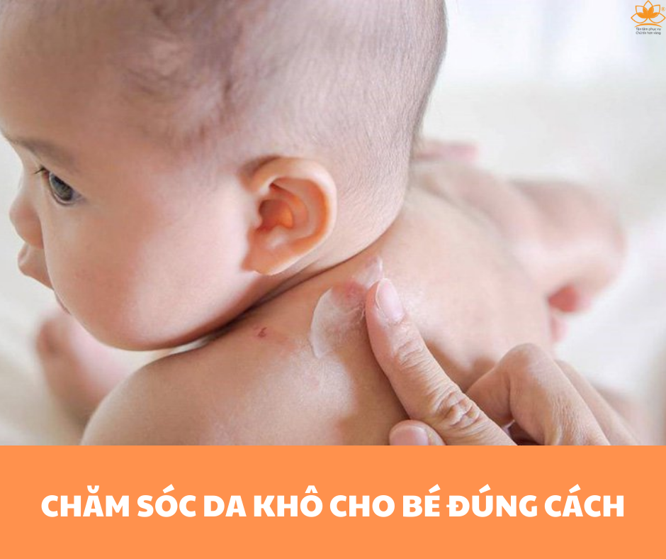 CHĂM SÓC DA KHÔ CHO BÉ ĐÚNG CÁCH
